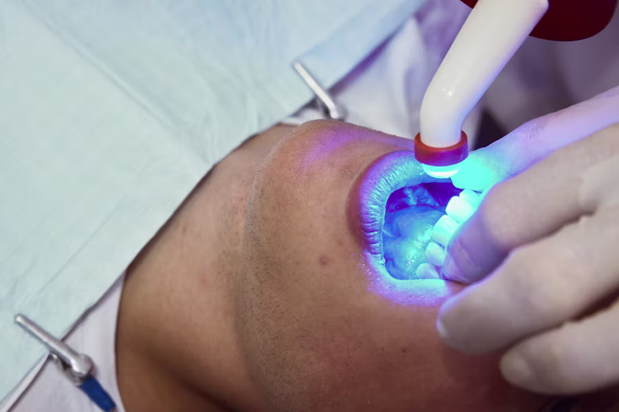 Sbiancamento denti professionale in studio — Studio Dentistico Zaccarelli