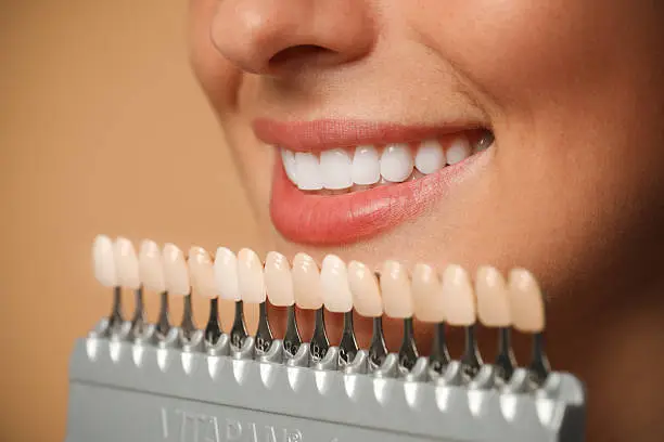 Sorriso perfetto con trattamenti di estetica dentale — Studio Dentistico Zaccarelli